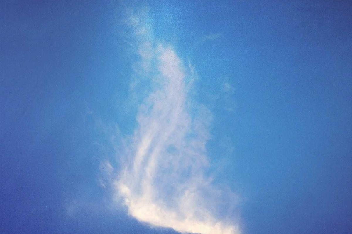 Image for Why Surgical Robots Are Becoming Standard in Operating Rooms Worldwide